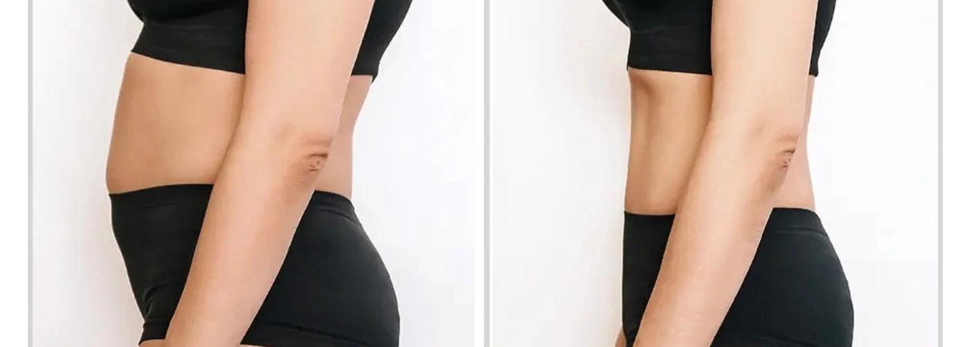 Post Pregnancy Diet Plan for Weight Loss