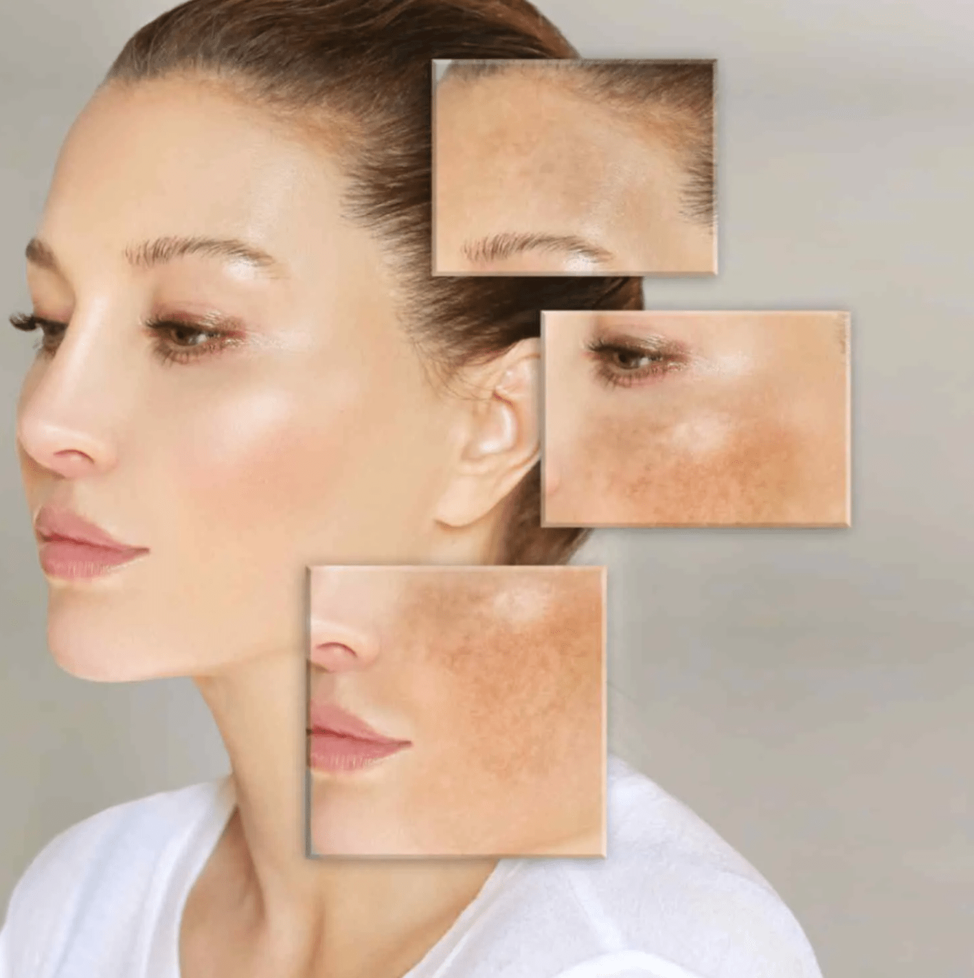 Skin Whitening Treatment in India: Costs, Facial Types, and Results