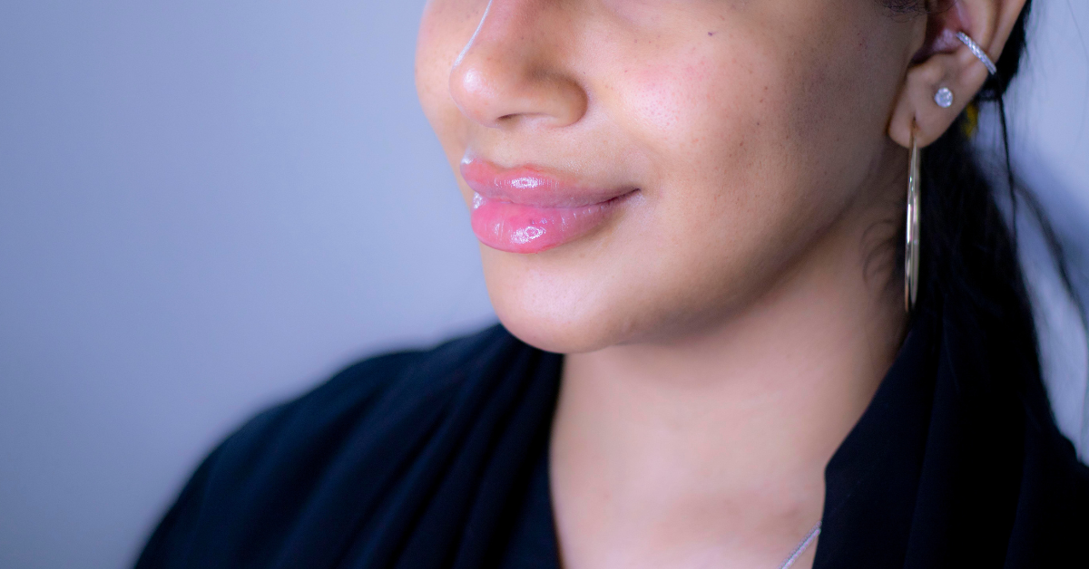 Dark Lips aka Smoker’s Lips Treatment in Dubai